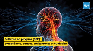 المجلة الطبية Sclérose en plaques (SEP) : symptômes, causes, traitements et évolution
