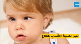 Magazine العين الكسولة : الأسباب والعلاج