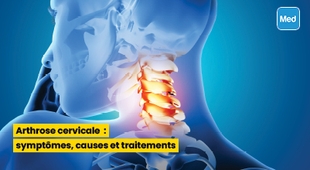 المجلة الطبية Arthrose cervicale : symptômes, causes et traitements