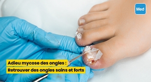 المجلة الطبية Adieu mycose des ongles : Retrouver des ongles sains et forts