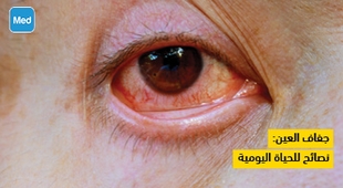 المجلة الطبية جفاف العين: نصائح للحياة اليومية