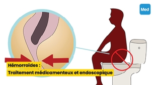 المجلة الطبية Hémorroïdes : Traitement médicamenteux et endoscopique