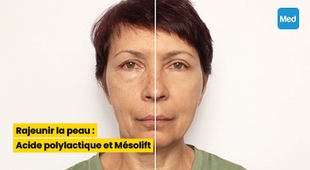 المجلة الطبية Rajeunir la peau : Acide polylactique et Mésolift
