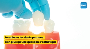 Makaleler Remplacer les dents perdues : bien plus qu'une question d'esthétique