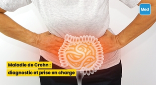 Magazine Maladie de Crohn : diagnostic et prise en charge