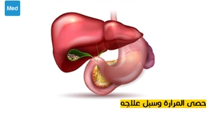 Magazine حصى المرارة وسبل علاجه