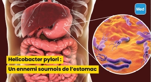 Magazine Helicobacter pylori : Un ennemi sournois de l'estomac