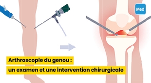 Magazine Arthroscopie du genou : un examen et une intervention chirurgicale