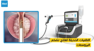 Makaleler التقنيات الحديثة لعلاج تضخم البروستات