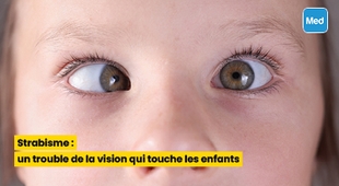 Magazine Strabisme : un trouble de la vision qui touche les enfants