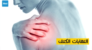 Makaleler التهابات الكتف 
