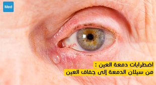 المجلة الطبية اضطرابات دمعة العين : من سيلان الدمعة إلى جفاف العين