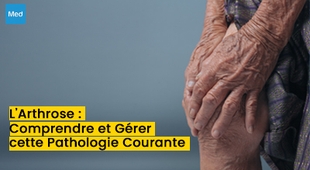 Makaleler L'Arthrose : Comprendre et Gérer cette Pathologie Courante