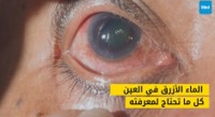 Magazine الماء الأزرق: كل ما تحتاج معرفته عن الزرق العيني