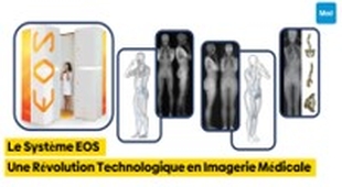 Makaleler Le Système EOS : Une Révolution Technologique en Imagerie Médicale