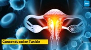 Magazine Cancer du col en Tunisie