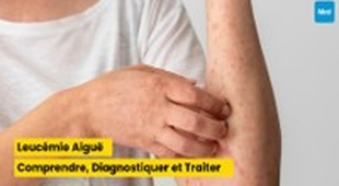 المجلة الطبية Leucémie Aiguë : Comprendre, Diagnostiquer et Traiter