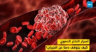 المجلة الطبية أسرار التخثر الدموي: كيف يتوقف دمنا عن الجريان
