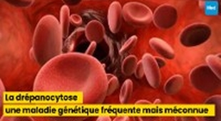Magazine La drépanocytose : une maladie génétique fréquente mais méconnue