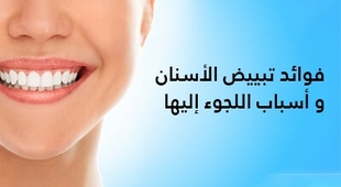 Makaleler فوائد تبييض الأسنان و أسباب اللجوء إليها 