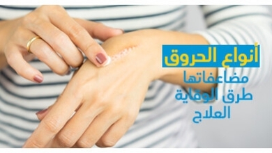 أنواع الحروق و مضاعفاتها و طرق الوقاية و العلاج