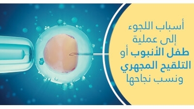 أسباب اللّجوء إلى عمليّة طفل الأنبوب أو التّلقيح المجهري ونسب نجاحها