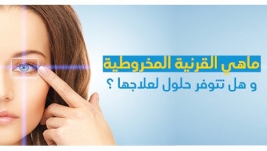 ماهي القرنيّة المخروطيّة و هل تتوفّر حلول لعلاجها ؟ 