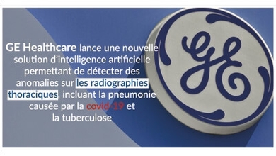 GE Healthcare lance une nouvelle solution d’intelligence artificielle permettant de détecter des anomalies sur les radiographies thoraciques, incluant la pneumonie causée par la covid-19 et la tuberculose