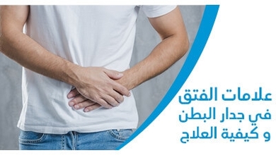 علامات الفتق في جدار البطن وكيفيّة العلاج 
