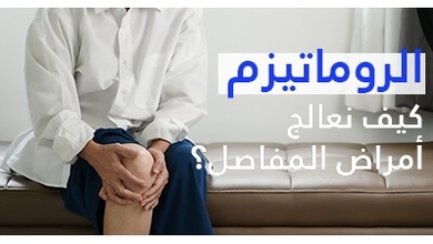 الروماتيزم: اعراض الروماتيزم
