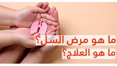  مرض السل ما هو العلاج