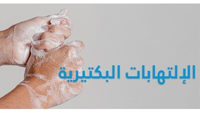 الإلتهابات البكتيرية