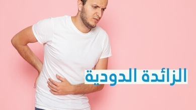 الزائدة الدودية