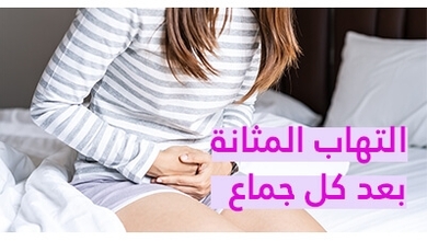 التهاب المثانة بعد كل جماع