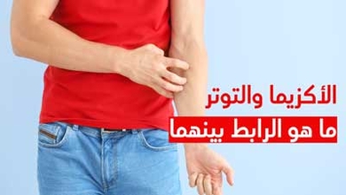 الأكزيما والتوتر ما هو الرابط بينهما