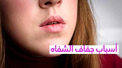 أسباب جفاف الشفاه