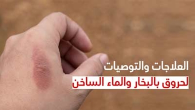 العلاجات والتوصيات لحروق بالبخار والماء الساخن