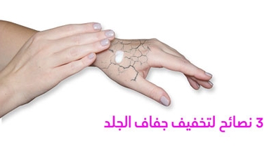 3 نصائح لتخفيف جفاف الجلد