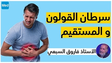 سرطان القولون و المستقيم