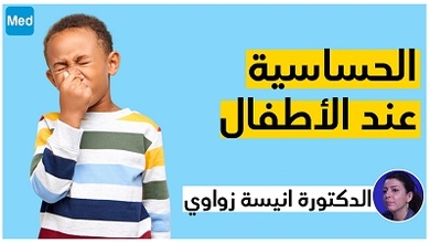 الحساسية عند الأطفال