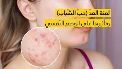 لعنة العدّ (حبّ الشّباب) وتأثيرها على الوضع النّفسي 