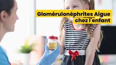  Glomérulonéphrites Aigue chez l