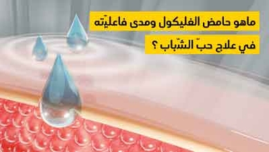 ماهو حامض الغليكول ومدى فاعليّته في علاج حبّ الشّباب ؟