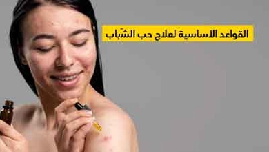 القواعد الأساسية لعلاج حب الشّباب