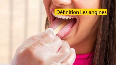 Définition Les angines