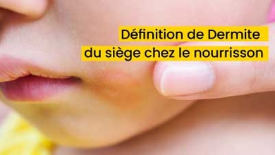 Définition de Dermite du siège chez le nourrisson