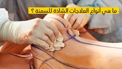 ما هي أنواع العلاجات الشاذة للسمنة ؟