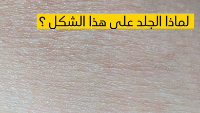    لماذا الجلد على هذا الشكل ؟
