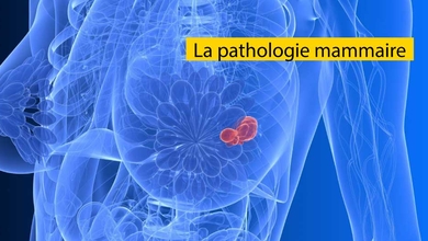 la pathologie mammaire