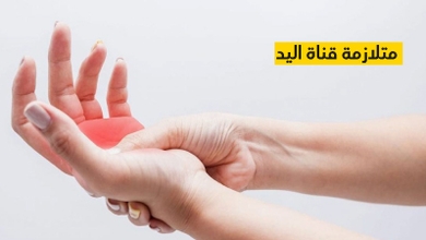 متلازمة قناة اليد